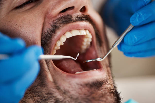 Best Emergency Dental Care for Broken or Chipped Teeth in Tornillo, TX